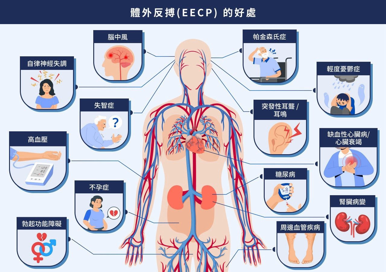 體外反搏的好處：腦中風、帕金森氏症、失智症、高血壓、糖尿病、腎臟病變等