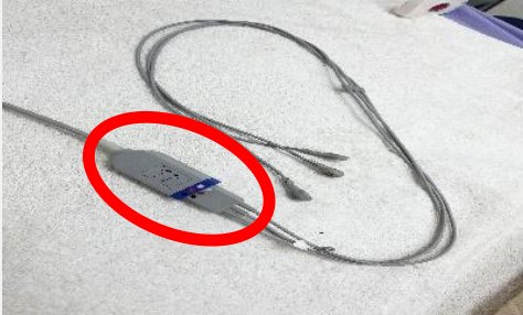 心電源線中間接頭