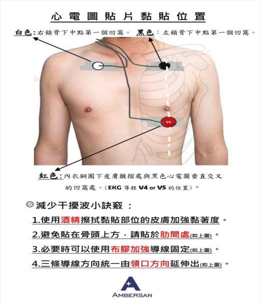 心電圖貼片黏貼位置與減少干擾小訣竅